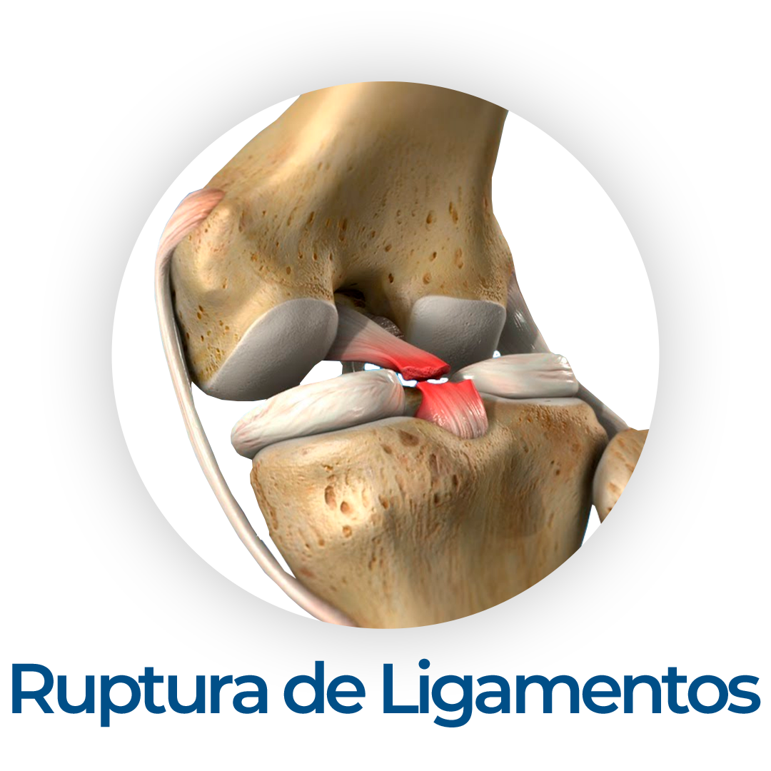 ligamentos